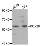 Western blot analysis of extracts of various cell lines, using DDX28 antibody.