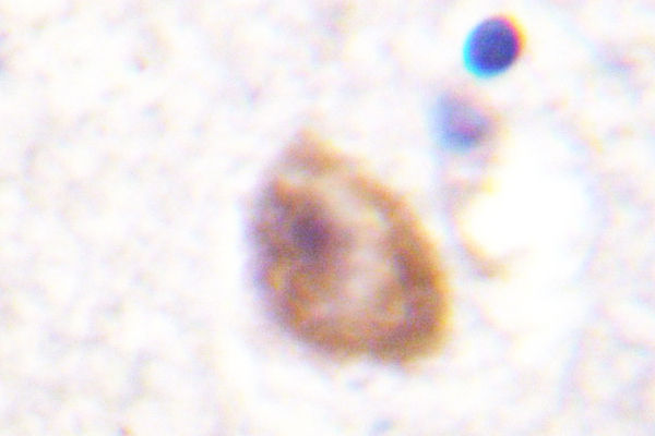 IHC of DDX3 (L318) pAb in paraffin-embedded human brain tissue.