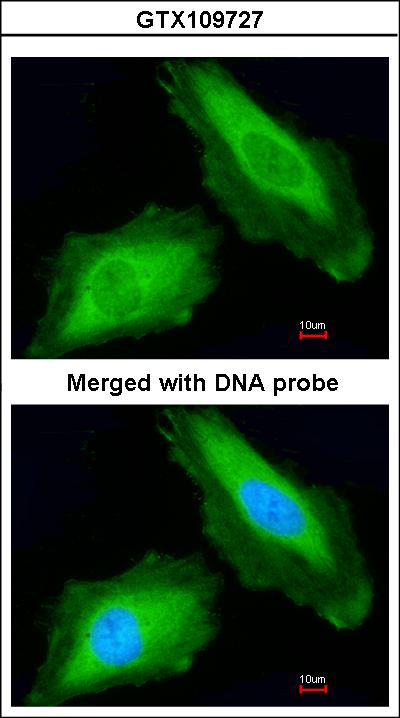 Immunofluorescence of paraformaldehyde-fixed HeLa using DDX3Y antibody at 1:200 dilution.