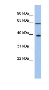 DDX3X antibody LS-C110145 Western blot of THP-1 cell lysate.