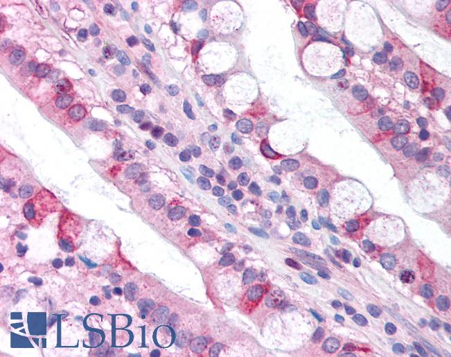 Anti-CLDN18 / Claudin 18 antibody IHC of human small intestine. Immunohistochemistry of formalin-fixed, paraffin-embedded tissue after heat-induced antigen retrieval. Antibody LS-B940 concentration 5 ug/ml.