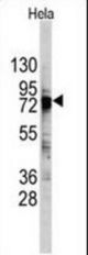 Western blot of DDX3 Antibody in HeLa cell line lysates (35 ug/lane). DDX3 (arrow) was detected using the purified antibody.