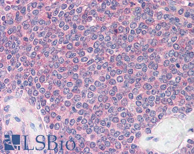 Anti-DDX3X antibody IHC of human spleen. Immunohistochemistry of formalin-fixed, paraffin-embedded tissue after heat-induced antigen retrieval. Antibody LS-B2615 concentration 5 ug/ml.