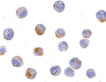 Immunocytochemistry of DDX3 in HepG2 cells with DDX3 antibody at 10 ug/ml.