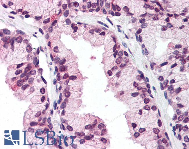 Anti-DDX3X antibody IHC of human prostate. Immunohistochemistry of formalin-fixed, paraffin-embedded tissue after heat-induced antigen retrieval. Antibody LS-B2348 concentration 5 ug/ml.