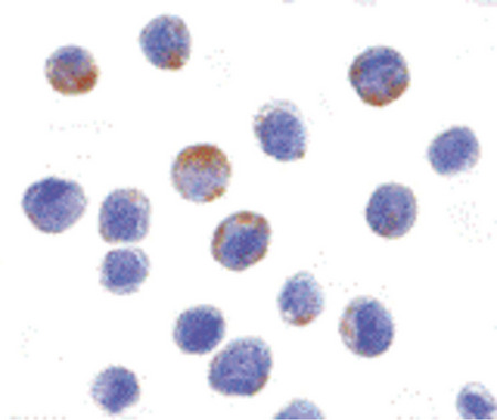 Immunocytochemistry of DDX3 in HepG2 cells with DDX3 antibody at 10 ug/ml.
