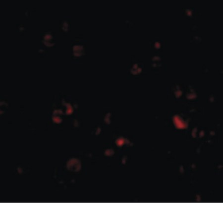 Immunofluorescence of DDX3 in HepG2 cells with DDX3 antibody at 20 ug/ml.