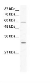 Jurkat Cell Lysate