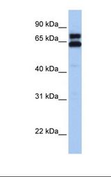 Fetal liver lysate. Antibody concentration: 1.0 ug/ml. Gel concentration: 12%.
