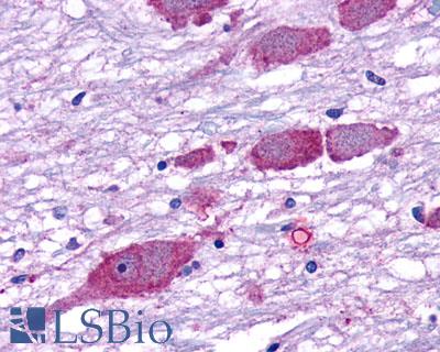 Anti-GPR162 antibody LS-A1695 IHC of human brain, neurons and glia. Immunohistochemistry of formalin-fixed, paraffin-embedded tissue after heat-induced antigen retrieval.