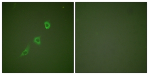 Immunofluorescence of NIH-3T3 cells, using HSP10 Antibody. The picture on the right is treated with the synthesized peptide.