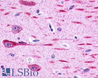 Anti-GPR162 antibody LS-A1692 IHC of human brain, neurons and glia. Immunohistochemistry of formalin-fixed, paraffin-embedded tissue after heat-induced antigen retrieval.