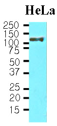 Cell lysates of HeLa(30 ug) were resolved by SDS-PAGE, transferred to NC membrane and probed with anti-human HSP105 a (1:1000). Proteins were visualized using a goat anti-mouse secondary antibody conjugated to HRP and an ECL detection system.