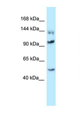 HSPH1 / HSP105 antibody LS-C145925 Western blot of Rat Brain lysate. Antibody concentration 1 ug/ml.