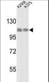 Western blot of HSPH1 Antibody in A2058 and A375 cell line lysates (35 ug/lane). HSPH1 (arrow) was detected using the purified antibody.