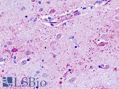 Human, Brain, neurons: Formalin-Fixed Paraffin-Embedded (FFPE)