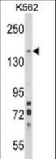 Western blot of SORCS1 Antibody in K562 cell line lysates (35 ug/lane). SORCS1 (arrow) was detected using the purified antibody.