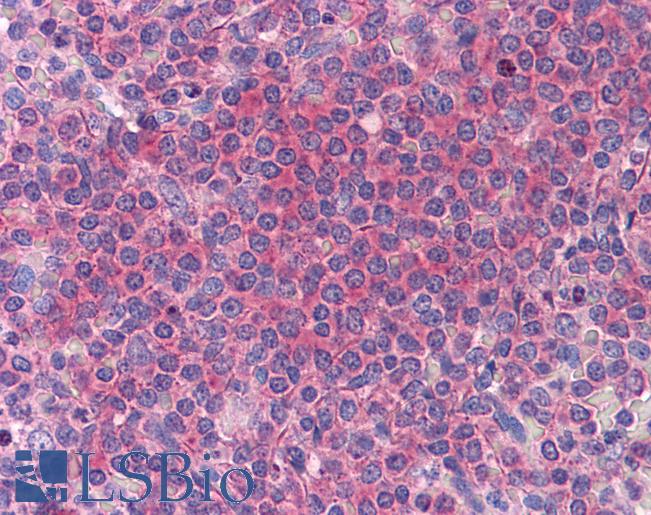 Anti-HYI antibody IHC of human spleen. Immunohistochemistry of formalin-fixed, paraffin-embedded tissue after heat-induced antigen retrieval. Antibody LS-B4539 concentration 5 ug/ml.