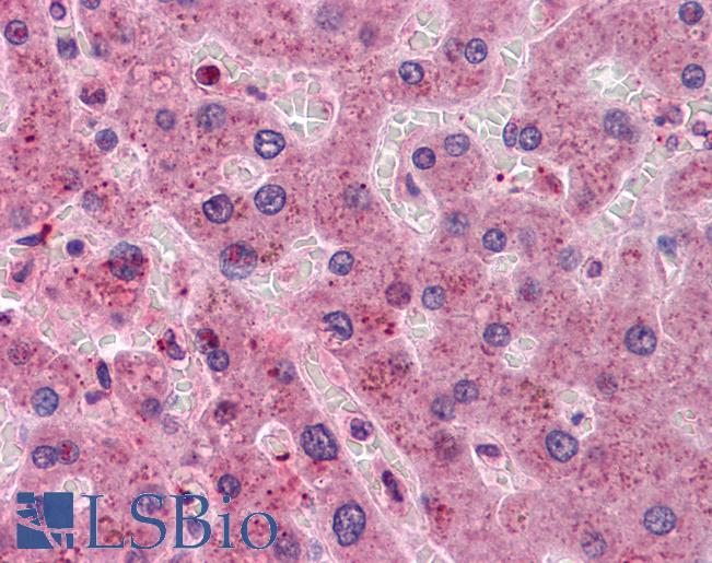 Anti-HYI antibody IHC of human liver. Immunohistochemistry of formalin-fixed, paraffin-embedded tissue after heat-induced antigen retrieval. Antibody LS-B4539 concentration 5 ug/ml.