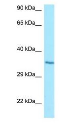 HT036 / HYI antibody Western Blot of Jurkat.