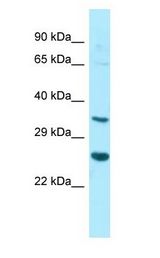 HT036 / HYI antibody Western Blot of U937.
