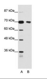A: Marker, B: Jurkat Cell Lysate