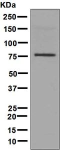 Western blot analysis on fetal muscle lysate using anti-TRIM32 antibody.