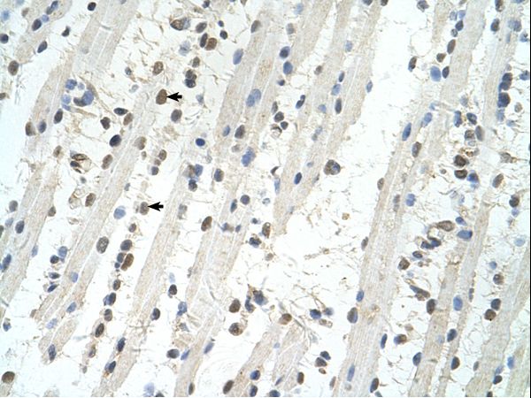 TRIM32 antibody LS-C80244 was used in IHC to stain formalin-fixed, paraffin-embedded human muscle.