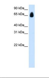 Transfected 293T cell lysate. Antibody concentration: 1.25 ug/ml. Gel concentration: 12%.