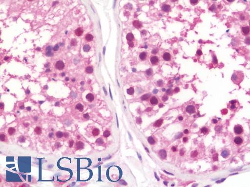 Anti-HT2A / TRIM32 antibody IHC staining of human testis. Immunohistochemistry of formalin-fixed, paraffin-embedded tissue after heat-induced antigen retrieval. Antibody LS-B10897 concentration 7.5 ug/ml.
