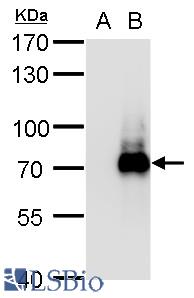 TRIM32 antibody detects TRIM32 protein by western blot analysis. A. 5 µg 293T whole cell lysate/extract B. 5 µg whole cell lysate/extract of DDDDK-human TRIM32-transfected 293T cells 7.5 % SDS-PAGE Dilution: 1:20000