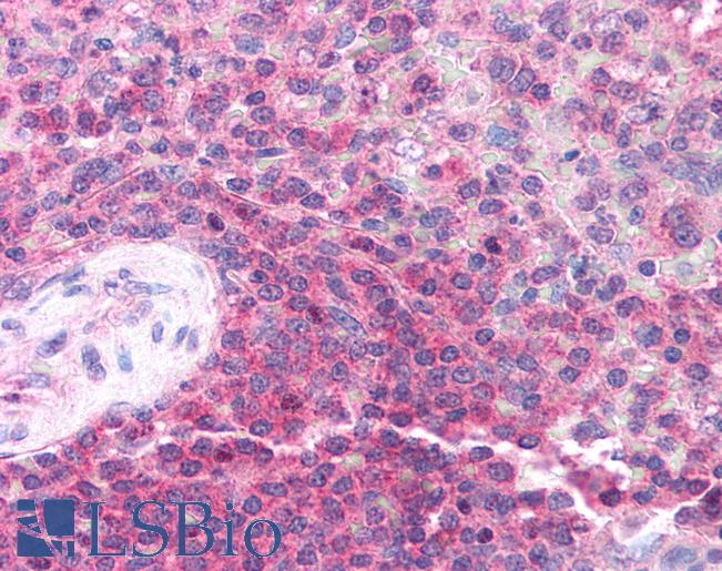 Anti-TRIM32 antibody IHC of human spleen. Immunohistochemistry of formalin-fixed, paraffin-embedded tissue after heat-induced antigen retrieval. Antibody LS-B1105 concentration 5 ug/ml.