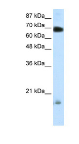 TRIM32 antibody LS-B1105 Western blot of Transfected 293T cell lysate.