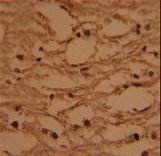 Formalin-fixed and paraffin-embedded human brain tissue with HTATSF1 Antibody , which was peroxidase-conjugated to the secondary antibody, followed by DAB staining. This data demonstrates the use of this antibody for immunohistochemistry; clinical relevance has not been evaluated.
