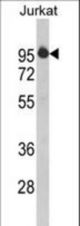 Western blot of HTATSF1 Antibody in Jurkat cell line lysates (35 ug/lane). HTATSF1 (arrow) was detected using the purified antibody.