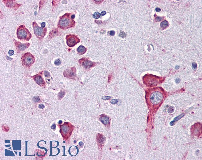 Anti-5HT1A Receptor antibody IHC of human brain, cortex. Immunohistochemistry of formalin-fixed, paraffin-embedded tissue after heat-induced antigen retrieval. Antibody LS-B6043 concentration 10 ug/ml.