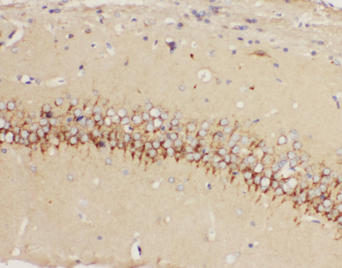 HTR1A / 5-HT1A Receptor antibody. IHC(P): Rat Brain Tissue.