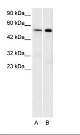 A: Daudi Cell Lysate, B: Raji Cell Lysate