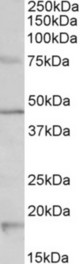 HTR1A antibody (1 ug/ml) staining of Mouse Brain lysate (35 ug protein in RIPA buffer). Primary incubation was 1 hour. Detected by chemiluminescence.