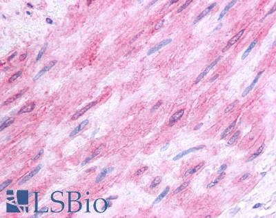 Anti-5HT1B Receptor antibody LS-A598 IHC of human vascular smooth muscle. Immunohistochemistry of formalin-fixed, paraffin-embedded tissue after heat-induced antigen retrieval.