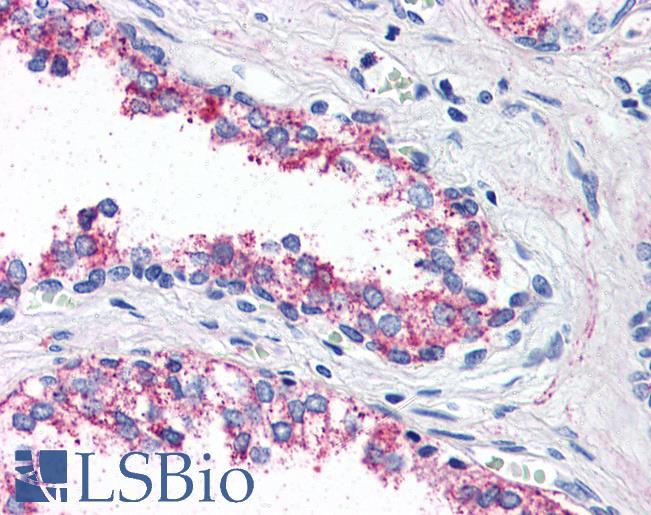 Anti-5HT1B Receptor antibody LS-A586 IHC of human prostate. Immunohistochemistry of formalin-fixed, paraffin-embedded tissue after heat-induced antigen retrieval.