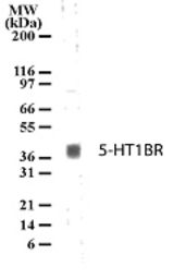 Western blot of 5-HT1BR in human brain lysate with anti-5-HT1BR pcAb. A protein band of approximate molecular weight of 40-41kD was detected.