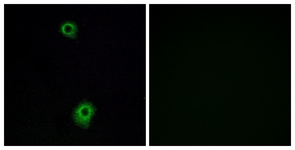 Immunofluorescence of A549 cells, using HTR1B Antibody. The picture on the right is treated with the synthesized peptide.