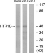Western blot of extracts from HepG2/MCF-7 cells, using HTR1B Antibody. The lane on the right is treated with the synthesized peptide.