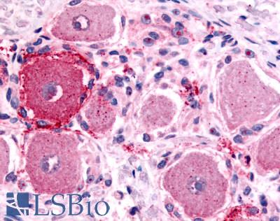 Anti-5HT1D Receptor antibody LS-A590 IHC of human spinal cord, dorsal root ganglion. Immunohistochemistry of formalin-fixed, paraffin-embedded tissue after heat-induced antigen retrieval.