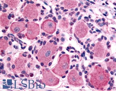 Anti-5HT1D Receptor antibody LS-A577 IHC of human spinal cord, dorsal root ganglion. Immunohistochemistry of formalin-fixed, paraffin-embedded tissue after heat-induced antigen retrieval.