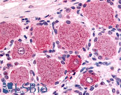 Anti-5HT1D Receptor antibody LS-A589 IHC of human spinal cord, dorsal root ganglion. Immunohistochemistry of formalin-fixed, paraffin-embedded tissue after heat-induced antigen retrieval.