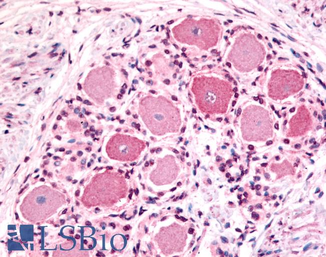 Anti-5HT1D Receptor antibody LS-A588 IHC of human spinal cord, dorsal root ganglion. Immunohistochemistry of formalin-fixed, paraffin-embedded tissue after heat-induced antigen retrieval.