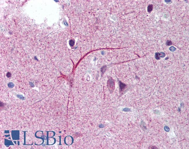 Anti-5HT1D Receptor antibody IHC of human brain, cortex. Immunohistochemistry of formalin-fixed, paraffin-embedded tissue after heat-induced antigen retrieval. Antibody LS-B2041 concentration 10 ug/ml.