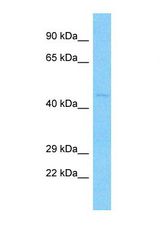 Western blot of Human A549. HTR1E antibody dilution 3.0 ug/ml.